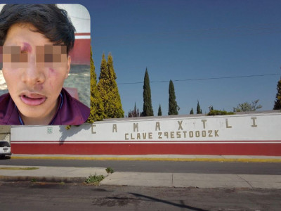 Golpean a alumno de la Secundaria Técnica 2 de Apizaco, dentro de la misma&nbsp;institución